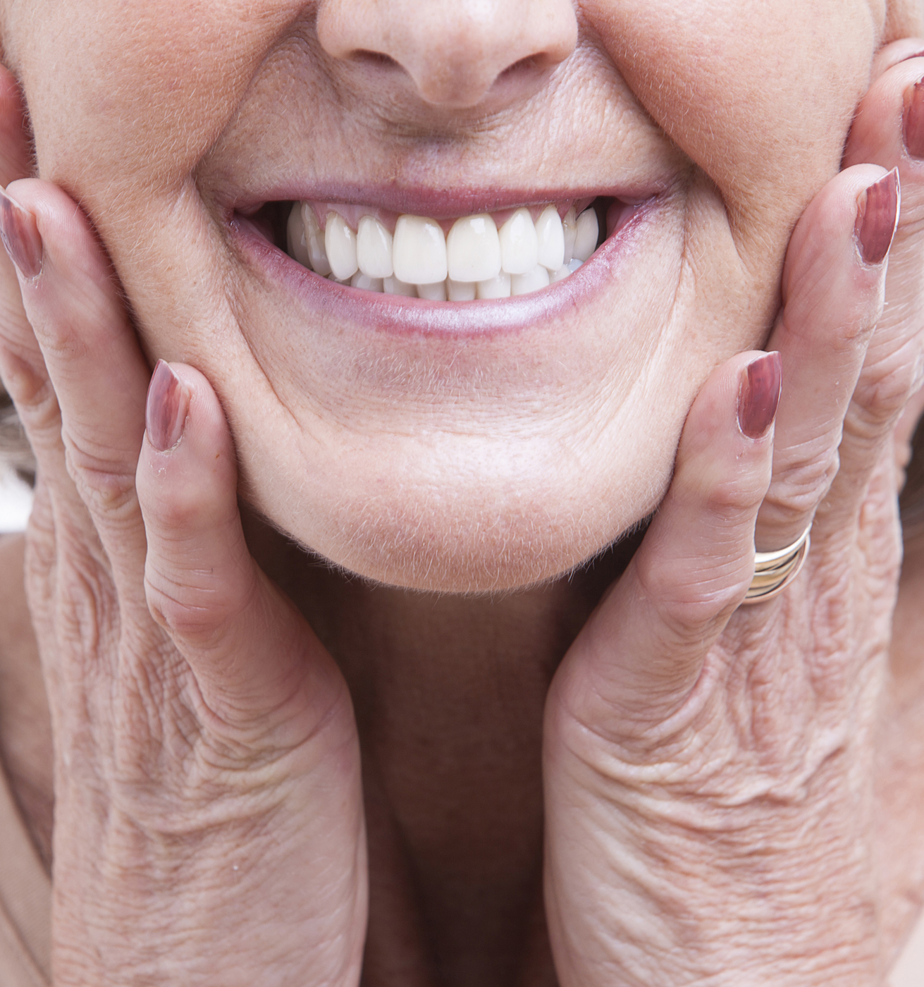 complete-partial-dentures-benefits