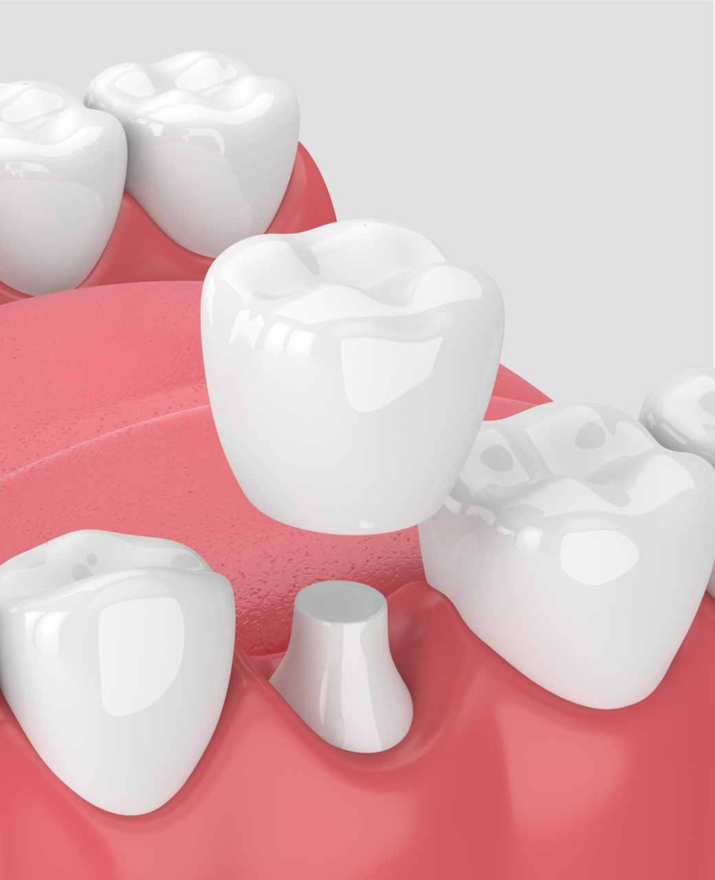 prosthodonticts