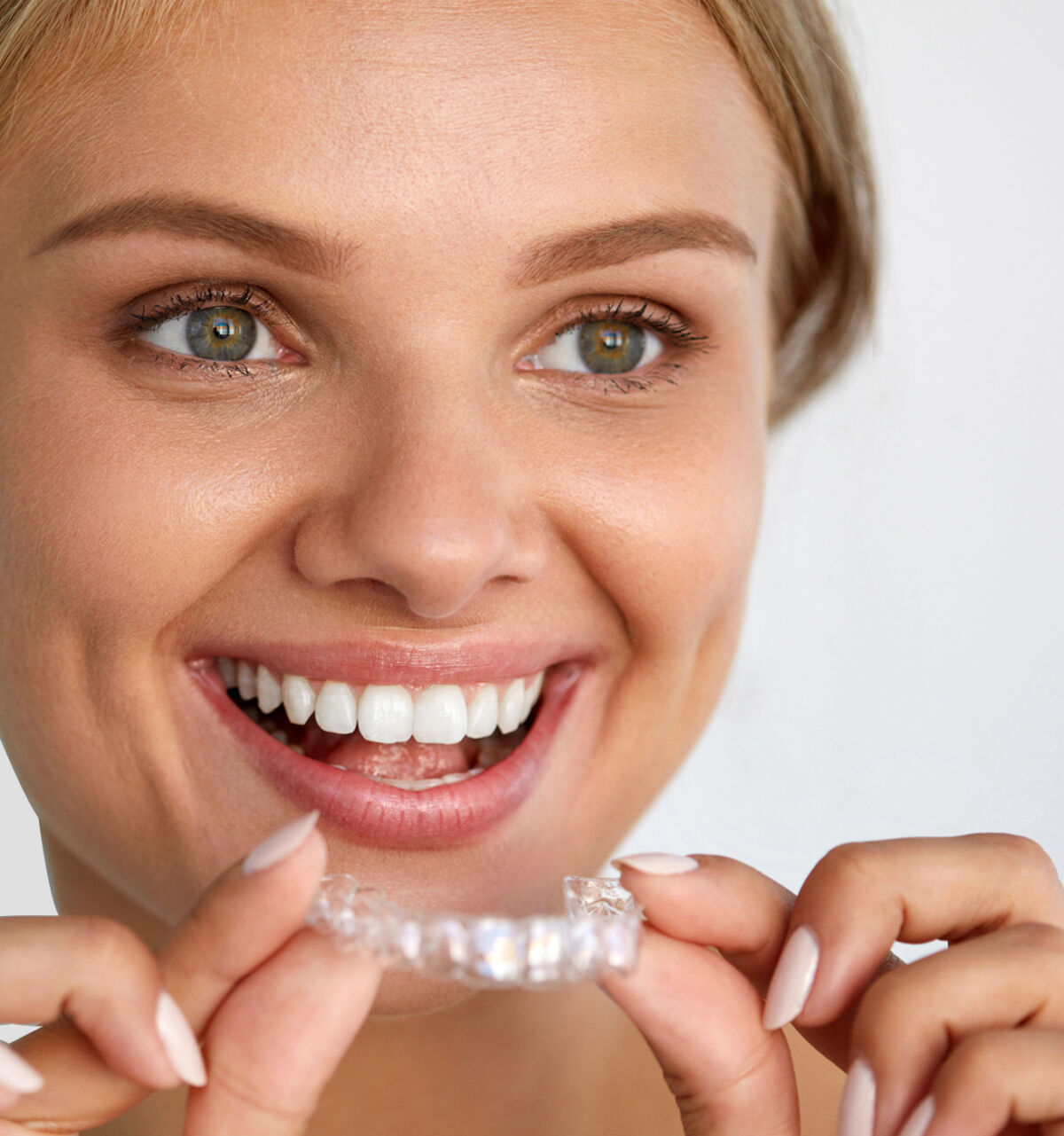 Teeth Whitening Calgary Chinook Dental Group
